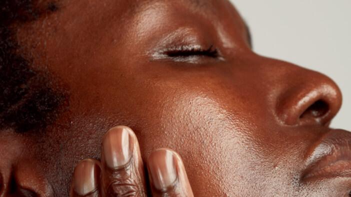 seborrheic dermatitis face african american